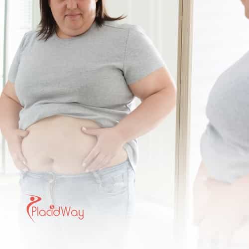 Bariatric Surgery in Cancún, Mexico: The Top Weight Loss Solution for Florida Residents